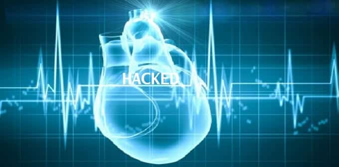 Terrorists can hack pacemakers like shown in Homeland TV series