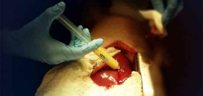 17 year old teenager invents VetiGel which can stop bleeding instantly