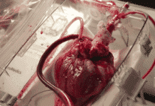 New 'Heart in a box' device can keep the heart alive for transplants