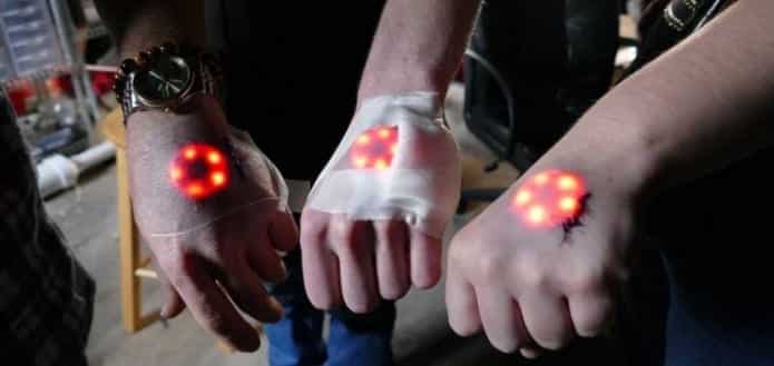 Biohackers implant LED’s under their skin